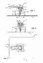 Fig. 04 - Apparatus and method for treating the foot