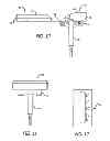 Fig. 06 - Apparatus and method for treating the foot