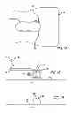 Fig. 08 - Apparatus and method for treating the foot