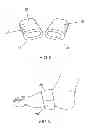 Fig. 03 - FOOT AND HAND EXERCISE DEVICE AND METHOD OF USE