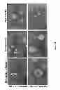 Fig. 22 - Compositions and methods for the treatment of cancer