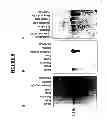 Fig. 06 - Lafora's disease gene