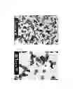Fig. 02 - Hexagonal prism-shaped zinc oxide particles, method for production of the same, and cosmetic, heat releasing filler, heat releasing resin composition, heat releasing grease, and heat releasing coating composition comprising the same
