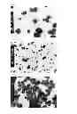 Fig. 04 - Hexagonal prism-shaped zinc oxide particles, method for production of the same, and cosmetic, heat releasing filler, heat releasing resin composition, heat releasing grease, and heat releasing coating composition comprising the same
