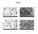 Fig. 08 - Biodegradable nitric oxide generating polymers and related biomedical devices