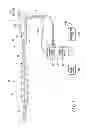 Fig. 02 - Endoscope and helical rotation member attached to insertion unit of this endoscope