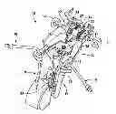 Fig. 01 - Surgical access system and related methods