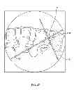 Fig. 28 - Surgical access system and related methods