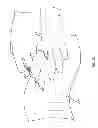 Fig. 34 - Surgical access system and related methods
