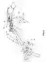 Fig. 44 - Surgical access system and related methods