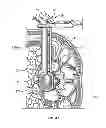 Fig. 48 - Surgical access system and related methods