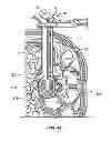 Fig. 49 - Surgical access system and related methods