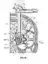 Fig. 50 - Surgical access system and related methods