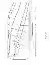 Fig. 25 - Fault-tolerant multielectrode array for brain implantable device