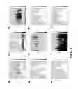 Fig. 09 - Method and Apparatus for Assessing Neurocognitive Status