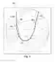Fig. 06 - Device, system, and method utilizing a radiopaque coil for anatomical lesion length estimation