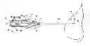 Fig. 01 - Apparatus for the percutaneous marking of a lesion