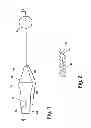 Fig. 02 - Apparatus for the percutaneous marking of a lesion