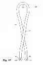 Fig. 08 - Apparatus for the percutaneous marking of a lesion
