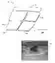 Fig. 01 - Adaptive Ultrasonic Array
