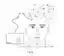 Fig. 07 - Location and deactivation of muscles