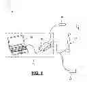 Fig. 02 - SPHINCTER CONTRACTION SENSOR