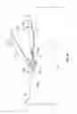 Fig. 11 - Anchor systems and methods