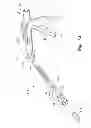 Fig. 06 - Bioinjection device having a tip with a plurality of directional dispersion apertures