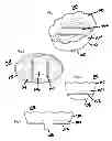 Fig. 02 - Cleansing device and method
