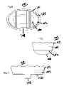 Fig. 03 - Cleansing device and method