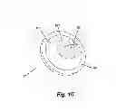 Fig. 08 - Apparatus for peripheral vascular access