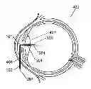 Fig. 01 - Method for the treatment of cataract