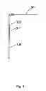 Fig. 04 - Method for the treatment of cataract