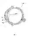 Fig. 06 - Method for the treatment of cataract