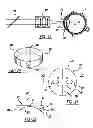 Fig. 11 - Adaptive laser system for ophthalmic surgery