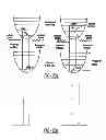 Fig. 12 - Adaptive laser system for ophthalmic surgery