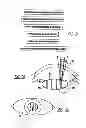Fig. 13 - Adaptive laser system for ophthalmic surgery