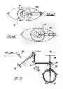Fig. 14 - Adaptive laser system for ophthalmic surgery