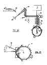 Fig. 15 - Adaptive laser system for ophthalmic surgery