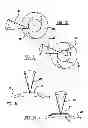 Fig. 16 - Adaptive laser system for ophthalmic surgery