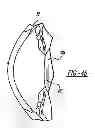 Fig. 22 - Adaptive laser system for ophthalmic surgery