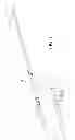 Fig. 02 - Cryosurgical probe with adjustable sliding apparatus