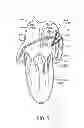 Fig. 07 - Methods and systems for accessing a pericardial space and preventing strokes arising from the left atrial appendage