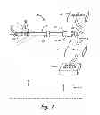 Fig. 02 - HIGH RESOLUTION MAP AND ABLATE CATHETER
