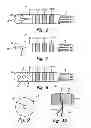 Fig. 04 - HIGH RESOLUTION MAP AND ABLATE CATHETER