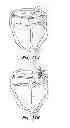 Fig. 05 - HIGH RESOLUTION MAP AND ABLATE CATHETER