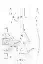 Fig. 02 - Renal nerve modulation devices with weeping RF ablation balloons