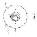 Fig. 06 - Renal nerve modulation devices with weeping RF ablation balloons