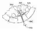 Fig. 01 - Joint arthroplasty devices and surgical tools