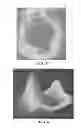 Fig. 05 - Joint arthroplasty devices and surgical tools